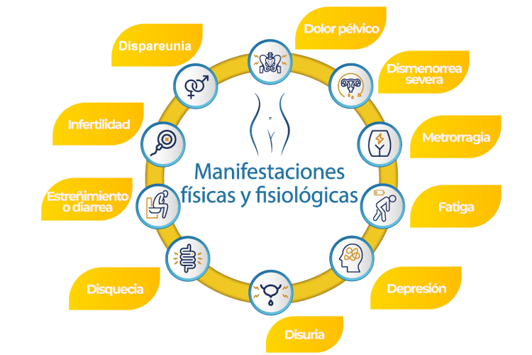 sinendometriosis-grafico-Web